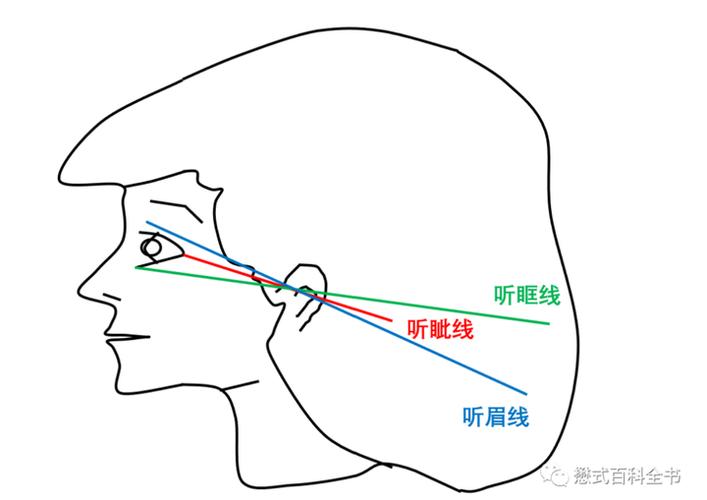 听眦线怎么读缩略图