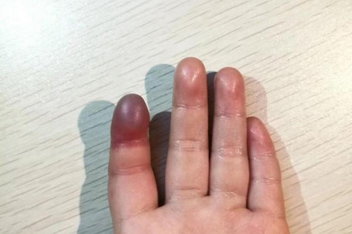 人死多久手指发紫图标