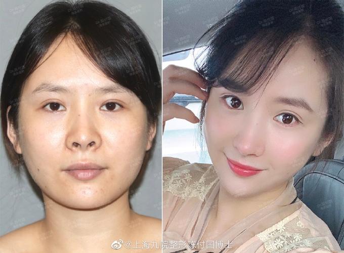 自拍摄像头打不开怎么办