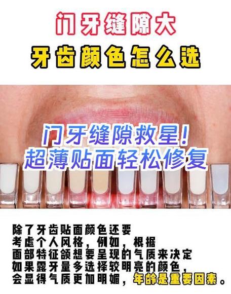 戴尔电脑自动修复无法修复你的电脑缩略图