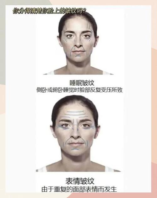 枕头太高对脸的影响