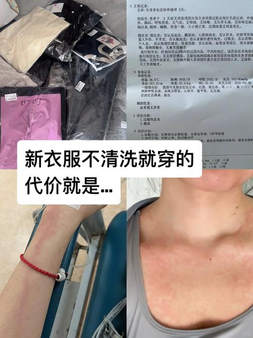 实体店买的衣服第二天可以换吗