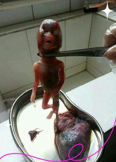 宝宝走了灵魂会去哪里了