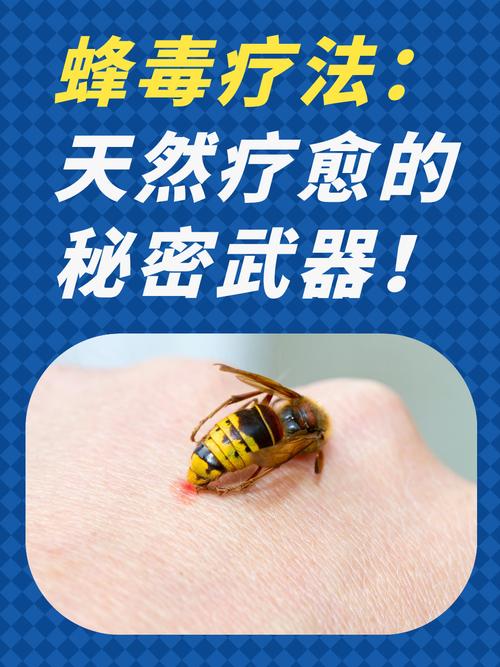蜂毒免费阅读更新版