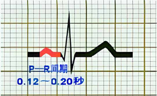 pr间期代表