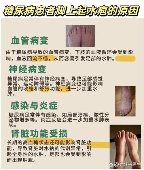 脚病宣传广告