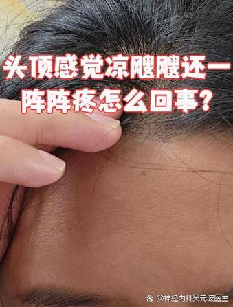 头顶受凉后会有什么后果?缩略图
