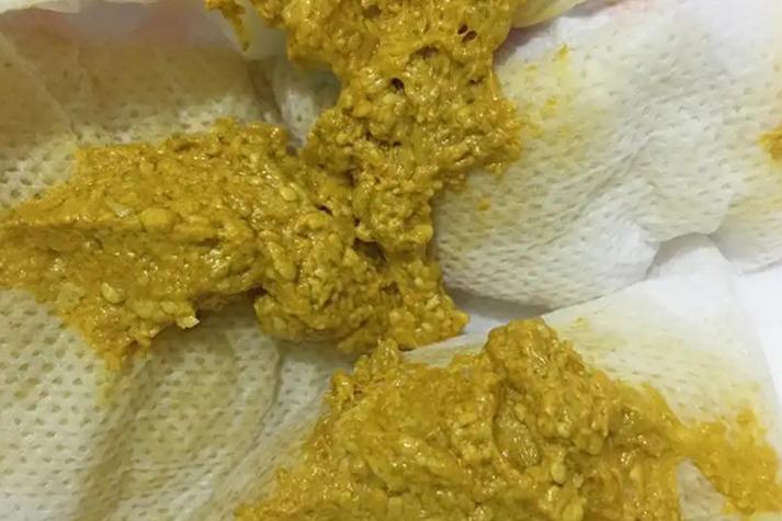 宝宝拉粑粑优酷视频