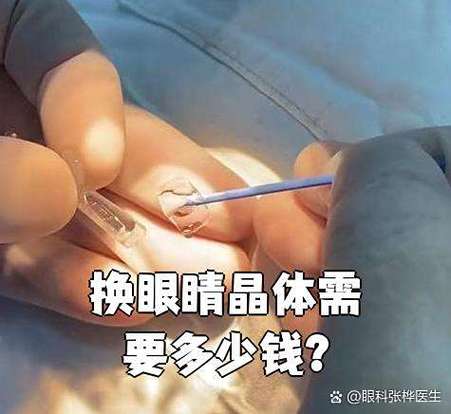 换眼球大概需要多少钱