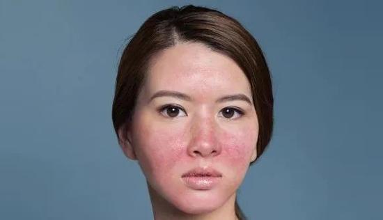 被巴掌打红了的照片截图