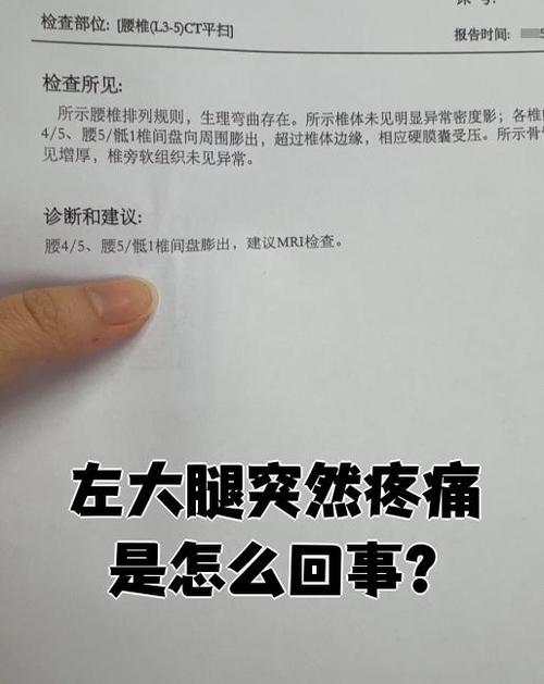 女人左腿疼痛位置图截图