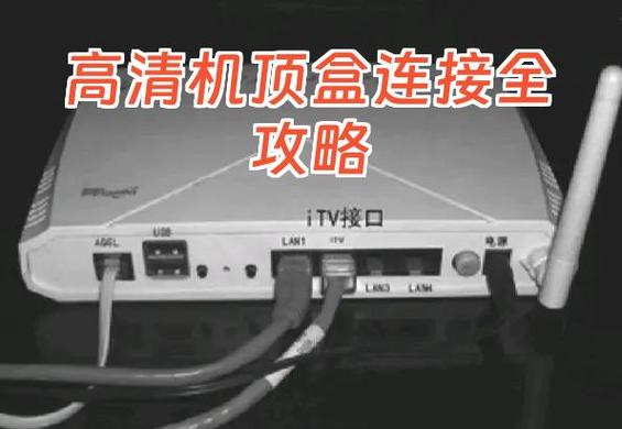 电信机顶盒怎么连接电视和路由器
