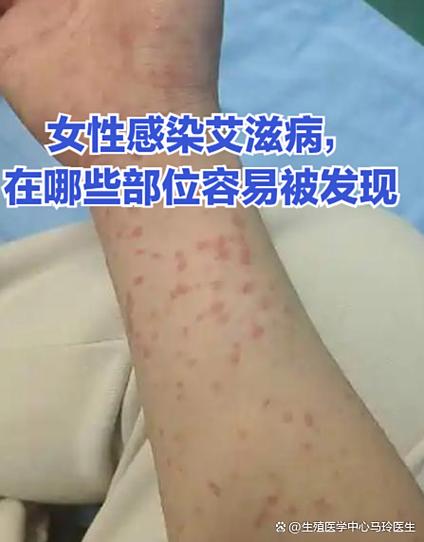 感染艾滋病最晚多久能查出来