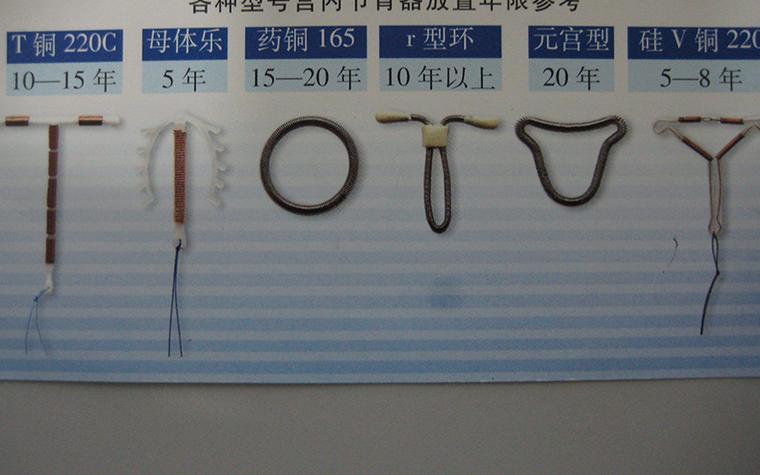 t型节育环几年换一次