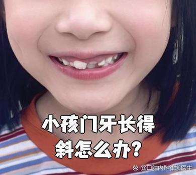大门牙刚长出来有点歪怎么办