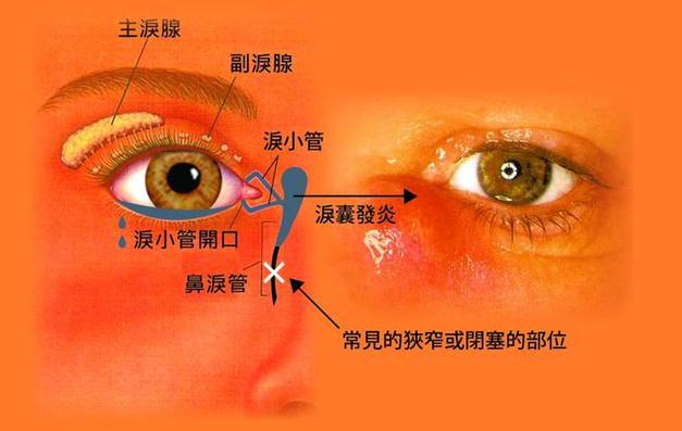 眼泪线在什么位置截图