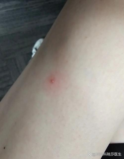 电脑屏幕中间一个红点