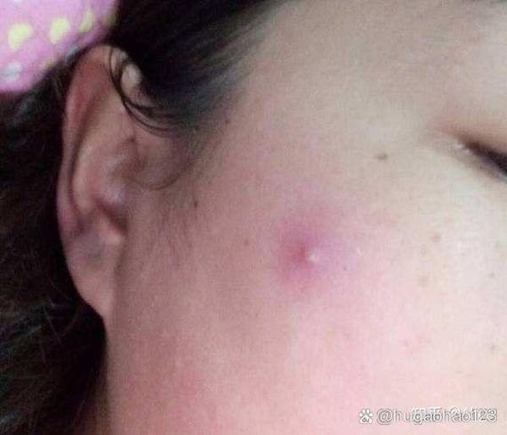 脸上长很多小红包缩略图