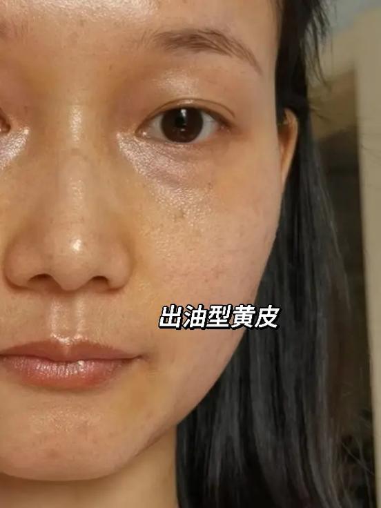人的脸色发黄是缺什么图标