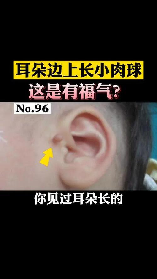 耳朵变小了是没福气了吗