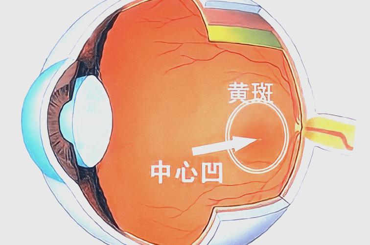 屏幕碎黄斑会越来越大