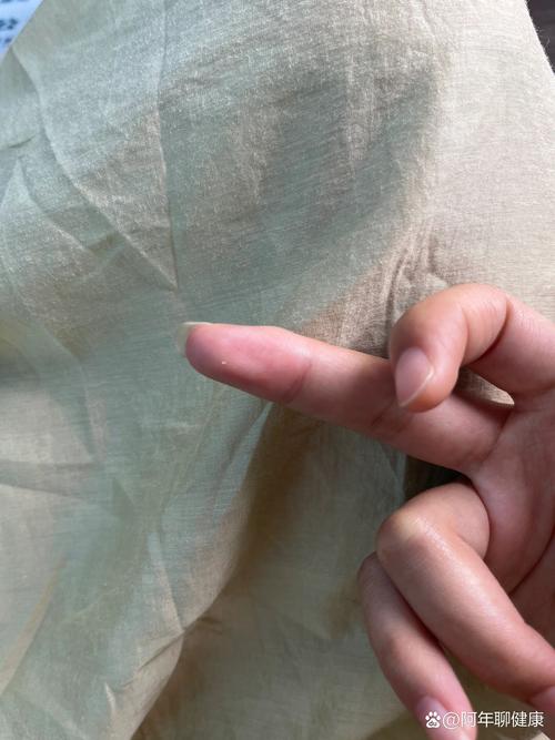 美团小白盒怎么扣点