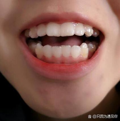 下牙代表什么亲人