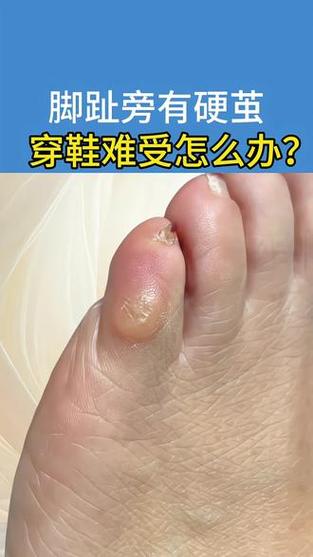 小茧
