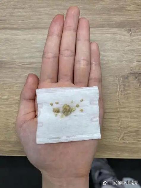人咳嗽出来的唾液很脏吗