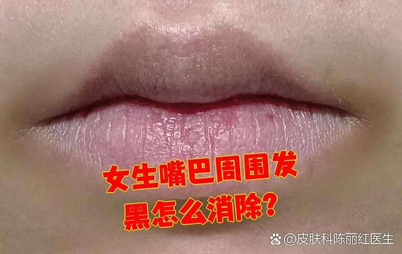 女生回复emm黑嘴是什么意思