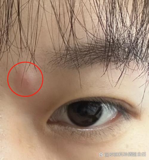两个眉头上方凸起