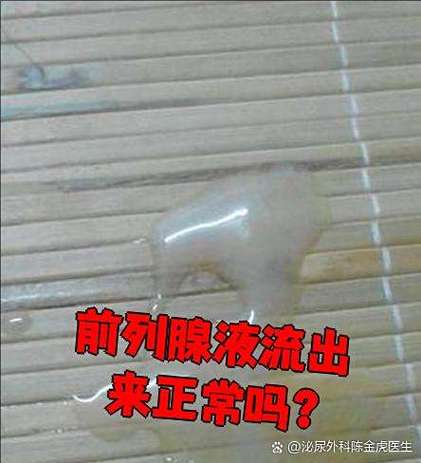 前列腺液如何快速排出体内