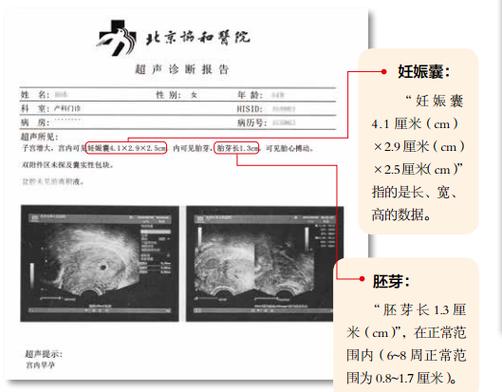 b超软件下载