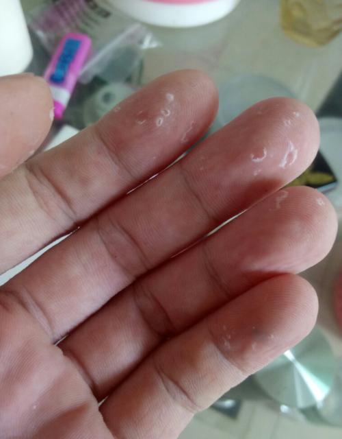 指纹脱皮后解不了锁