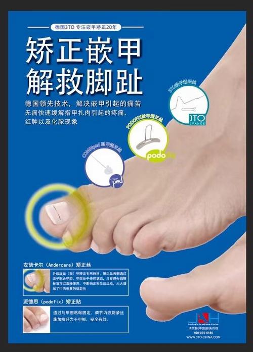 防止嵌甲怎么修剪脚趾甲