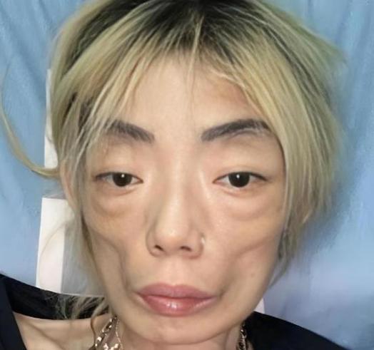 面容显得很焦碎