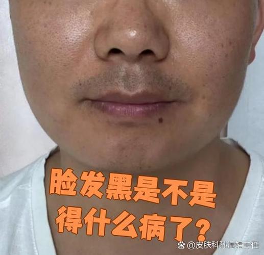 脸部变黑身体哪里出问题