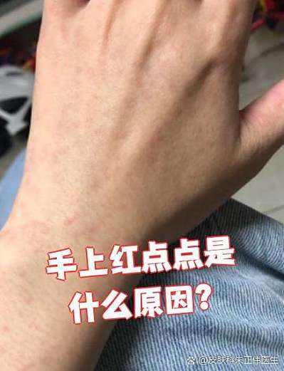手机屏幕上有红色的点缩略图