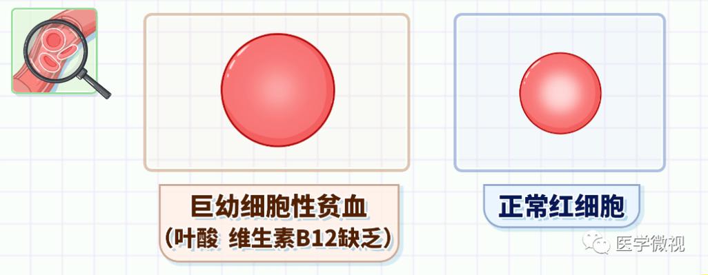 mch怎么算