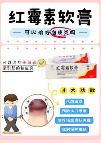 男性可以用克霉唑乳膏吗