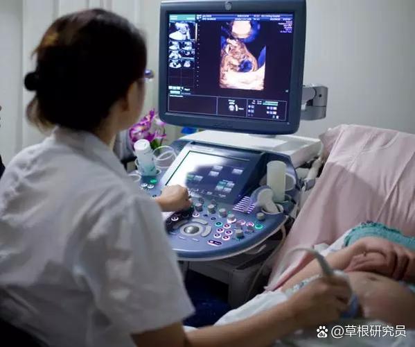私立医院做四维彩超多少钱