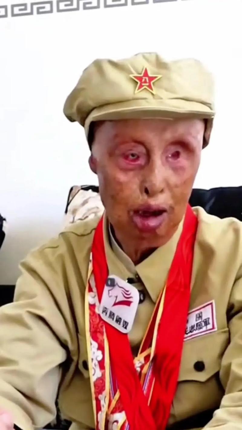 英雄联盟最肉的英雄