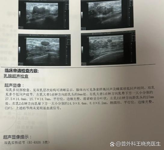 什么叫低回声结节