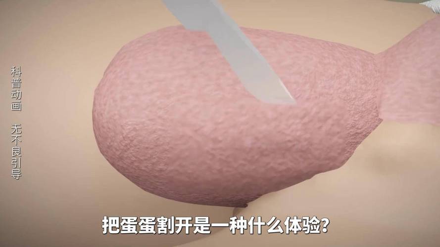 兽人割蛋蛋手术全过程