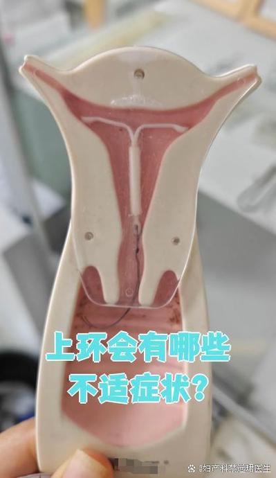 环戴久了会出现什么症状