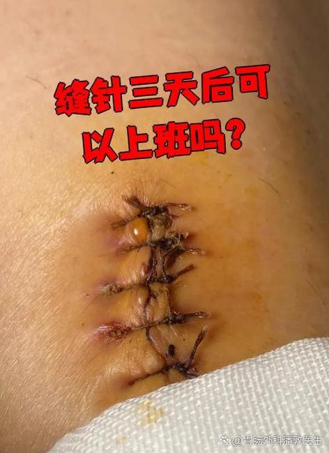 老式缝纫机针价格缩略图