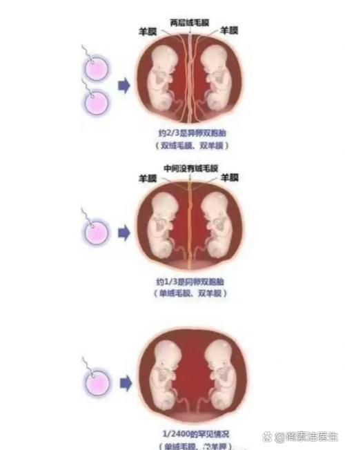 双胞胎一个是三级一个是七级是什么