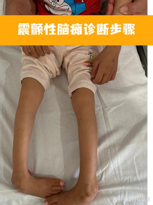 aapnh综合症游戏截图