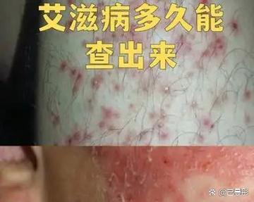 艾滋病多久可以查出来