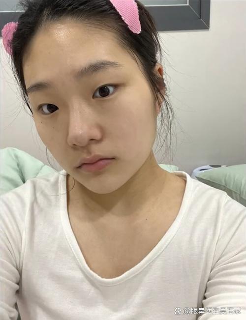 脸长的人前置和后置